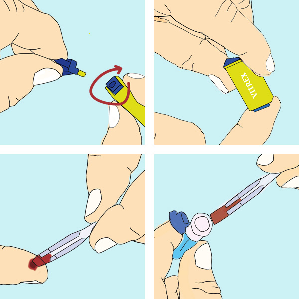 Diabetes-Screeningtest (HbA1c)